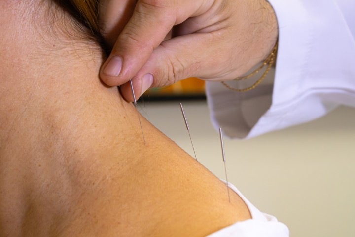 FOTO 4 -ACUPUNTURA SISTEMICA .jpg